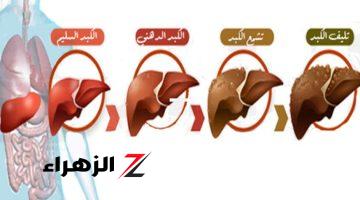 الأطباء يحذرون علامات تدل على أن الكبد ملئ بالسموم ويجب الذهاب فورا للطبيب قبل فوات الأوان