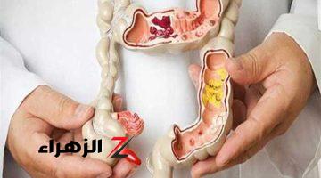 موجود في كل بيت.. تحذير عاجل من تناول كوبين من هذا المشروب يسبب السرطان