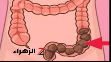 «طريقة الدكاترة هيخالفك طول العمر !!».. شابة أردنية تكشف عن عشبة جبارة موجودة في كل مطبخ تنظف القولون في 5 دقائق وتعتبر الحل الأمثل للتخلص من البراز المتحجر!