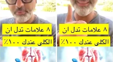 بالفيديو.. أخصائي يكشف عن 8 علامات تدل على سلامة الكلى وعملها بنسبة 100%