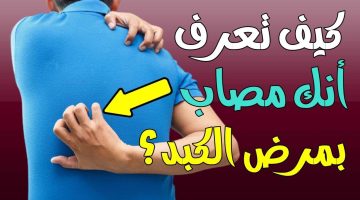 تحذير! قد تكون مصاب بمرض في الكبد إذا ظهرت عليك هذه الأعراض.. يجب أن تعرفها فوراً