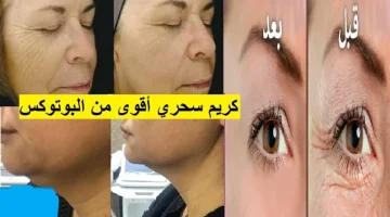 «فرحة ولا اي فرحة بجد دلعي بشرتك»..بديل البوتكس والفلر معجزة كريم الخميرة لنفخ الخدود وتسمين الوجه وتفتيح لون البشرة من اول مرة!!