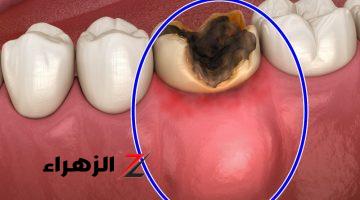 ضاع عمرنا وأحنا فاهمين غلط… أضرار ومخاطر استخدام عود أو خلة الأسنان | مهم جدًا