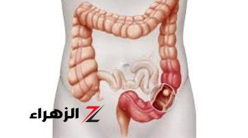 “نعمة ومعجزة كبيرة في هذا المشروب”..7 طرق مذهلة لتنظيف القولون في المنزل و اخراج البراز المتحجر دون الذهاب للطبيب.