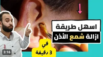 وفري مشوار الدكتور.. طريقة فعالة لتنظيف شمع الأذن في المنزل جربها فورا