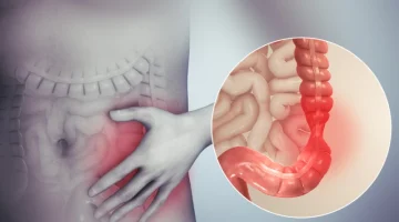 وصفة بمليون دولار ! كيف تتغلب على مشكلة انتفاخ البطن بعد الطعام ! نصائح فعالة للحصول على راحة دائمة!