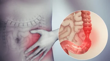 وداعًا للذهاب للطبيب… عشبة جبارة تساعد على تنظف القولون في 5 دقائق فقط وتعتبر الحل الأمثل للتخلص من البراز المتحجر