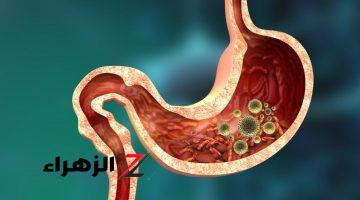 مش هتتوقع السبب ايه..!! ما هو سبب الاصابة بجرثومة المعدة وسرطان الامعاء.. احذر قبل فوات الاوان