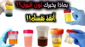 احذر.. أمراض يخبرك بها لون البول يجب معالجتها قبل فوات الأوان!