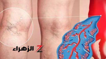 احترسوا فور ظهور هذه العلامات اذهب للطبيب فورا لأنها إشارة لمرض خطير