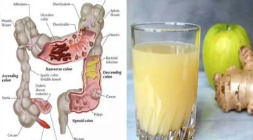 مشروب بيريح القولون على الاخر!!.. اقوى مشروب تنظيف وتطهير القولون من السموم سيخرج منك فضلات سنين في 3 أيام.. كان غايب عننا فين!!