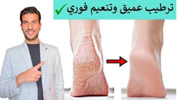 دهنة واحدة تصنع المعجزات .. تخلص نهائيا من تشققات وجفاف كعب القدم | ترطيب وتنعيم وتفتيح فوري للقدم والكوع 👌