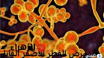 الفطر الأصفر القاتل الأشد شراسة أعراضه وهل علاجه متوافر في الصيدليات