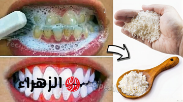 السر الذي لا يريد أطباء الأسنان أن تعرفه: إزالة الجير وتبييض الأسنان في دقيقتين فقط