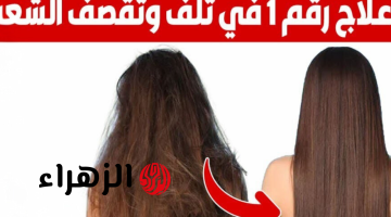 مكون سحري لن تتوقعيه.. علاج نهائي للشعر التالف والجاف و المتساقط| فعال 100%