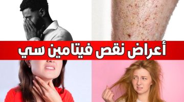 10 علامات تدل على نقص فيتامين سي فى الجسم.. هل لديك هذه الأعراض؟