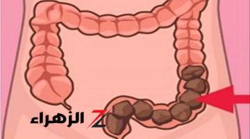 “كنز من دهب”..عشبة جبارة تنظف القولون وتخلصك من البراز المتحجر في دقائق؟!..مش هتقدر تتخيل حياتك من غيرها!!