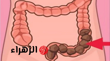 «قاهر البراز المتحجر».. شابة أردنية تكشف عن عشبة جبارة موجودة في كل مطبخ تنظف القولون في 5 دقائق وتعتبر الحل الأمثل للتخلص من البراز المتحجر!