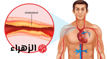 العلاقة الخفية بين ارتفاع الكوليسترول ومستويات السكر!!.. كيف تؤدي اضطرابات الدهون إلى تفاقم مخاطر السكري ومضاعفاته الصحية؟!!