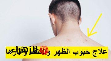 ملعقة واحدة من هذا المكون سيخلصك نهائيا من حبوب الظهر والكتف