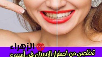 ٦ طرق سحرية مذهله لتبيض الاسنان فى المنزل