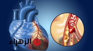 احذر قبل فوات الأوان.. علامات تشير إلى انسداد شرايين القلب وتعرضك للموت المفاجئ .. الحق نفسك قبل ما تموت