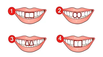 الفضائح هتكون للركب .. هل تعلم أن شكل أسنانك يكشف عن أسرار وصفات شخصيتك .. المستخبي كله هيبان