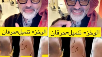 بالفيديو: مختص يكشف عن أسباب آلام وبرودة وتنميل القدم.. ويوضح حلولها الغذائية والطبية