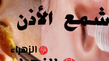 مش هتروح للدكاتره تاني.. طريقة جهنمية لإزالة الشمع من الأذن نهائيا.. ياريتني عرفتها من زمان!!