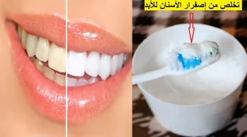 طرق مبتكرة للتخلص من إصفرار الأسنان المزعج وأنت في منزلك .. نتائج مبهرة !!