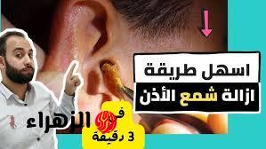 خلي ودانك فلة.. !! أفضل طريقة لإزالة الشمع من الأذن بدون ألم وفي 5 دقائق فقط.. ياريتني كنت عرفتها من زمان!!