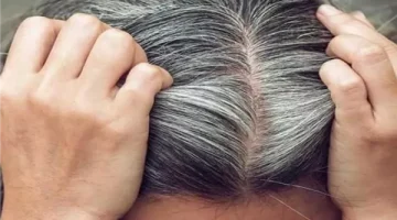 مفيش صبغات تاني… اكتشاف طريقة سهلة للتخلص من الشعر الأبيض