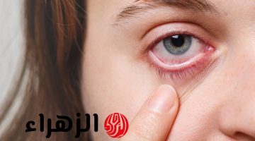 5 مؤشرات في العين تدل على أمراض.. بعضها “خطير”