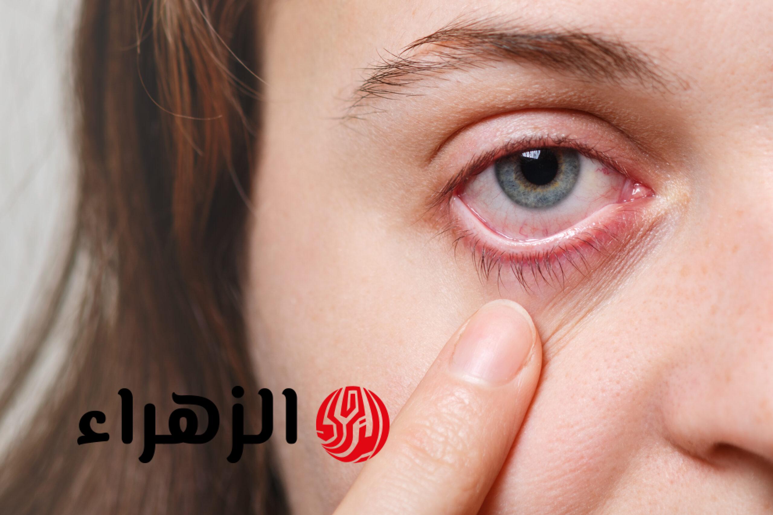 5 مؤشرات في العين تدل على أمراض.. بعضها “خطير”