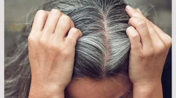 وداعاً للصبغات.. اكتشاف علاج ثوري للتخلص من الشعر الأبيض