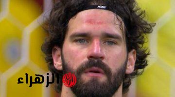 أليسون بيكر يغيب عن منتخب البرازيل ومباراة ليفربول ضد برايتون للإصابة