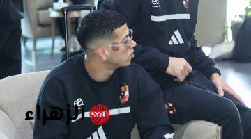 إمام عاشور يخطف الأنظار بعلامات الحجامة في رحلة الأهلي إلى تونس