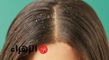 “جربيها وهتدعيلي”.. 4 حلول طبيعية تقضي على قشرة الرأس من أول مرة