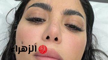 كارولين عزمي تعلق على إصابتها في برنامج رامز ليفل الوحش