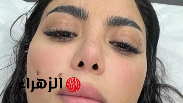 كارولين عزمي تعلق على إصابتها في برنامج رامز ليفل الوحش
