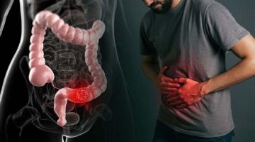 «معدتك في ورطة».. دليلك لتجاوز أشهر 5 مشكلات هضمية في رمضان